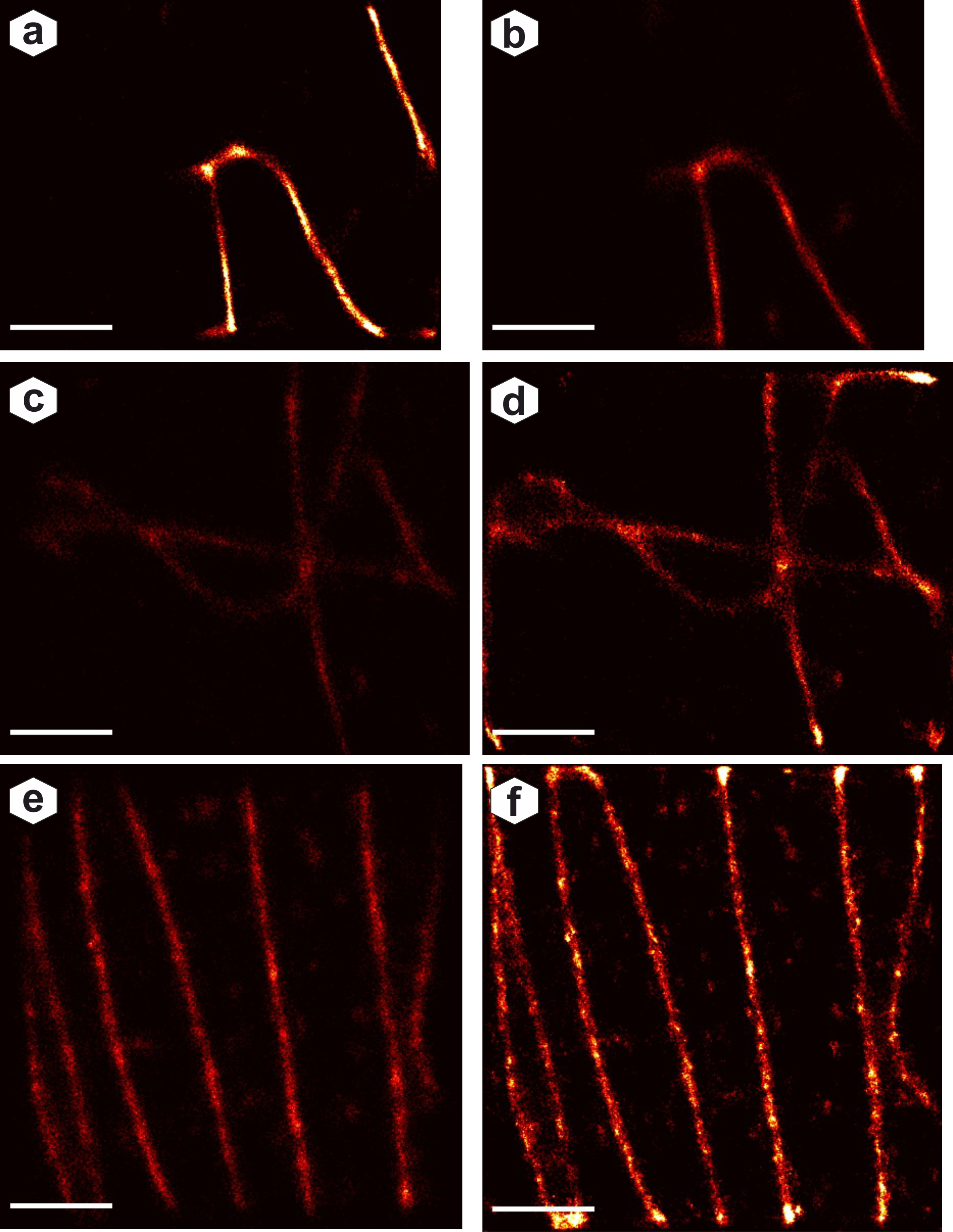 AI vs ThunderSTORM reconstruction comparison